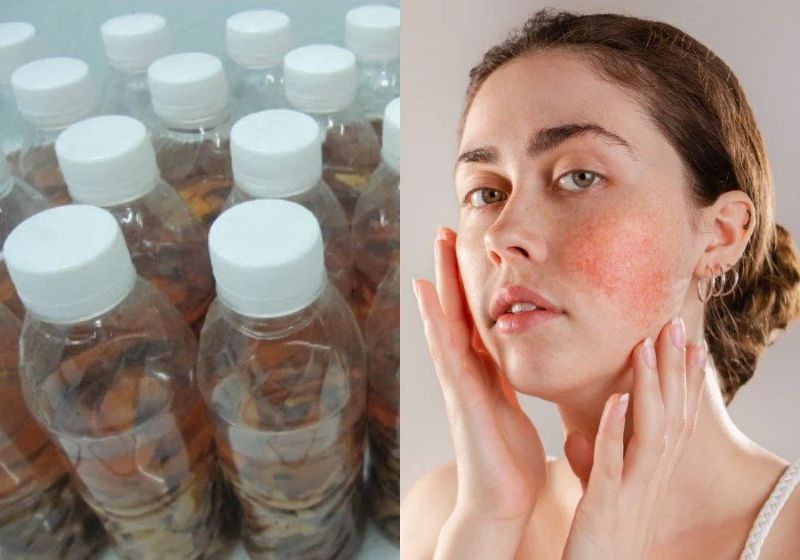 Cách phục hồi da sau khi sử dụng thuốc rượu