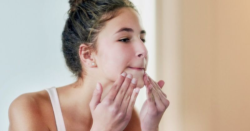 Lưu ý khi điều trị mụn nội tiết