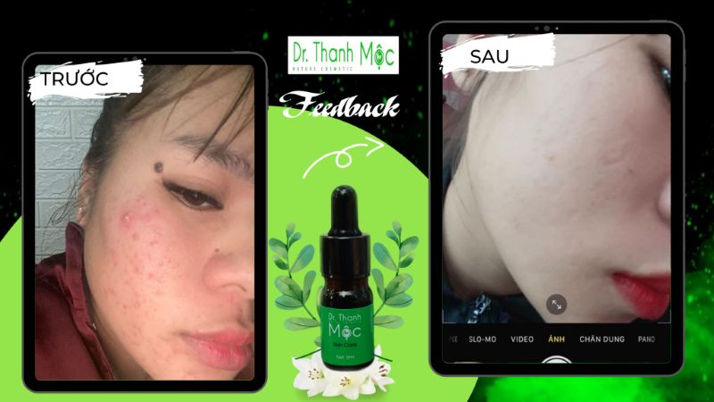 Một Số Lưu Ý Khi Sử Dụng Serum Dr Thanh Mộc