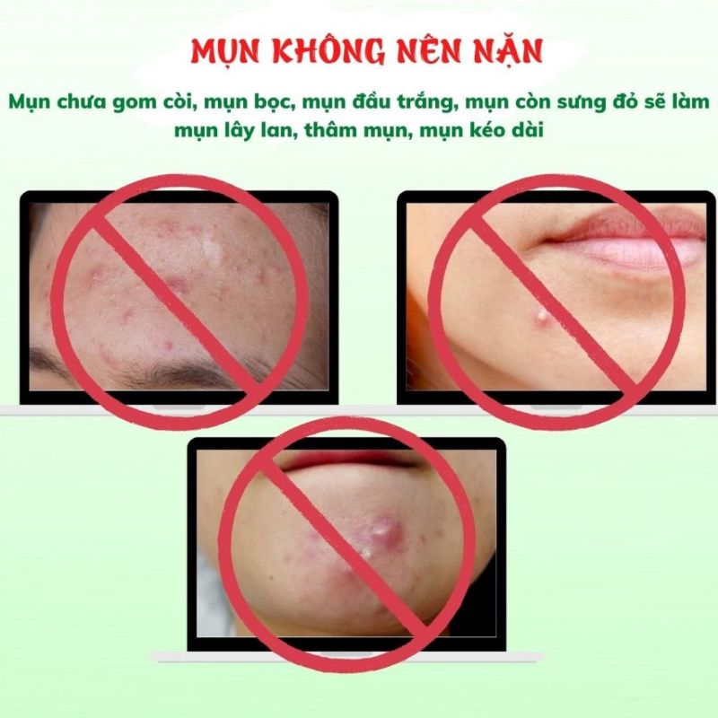 Tránh Nặn Mụn Trước Khi Sử Dụng Serum