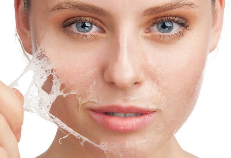 Các phương pháp điều trị nám da nội tiết