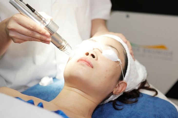 Cách chăm sóc da sau khi trị nám bằng laser