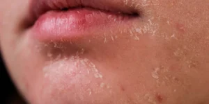 Nên bôi kem dưỡng ẩm khi nào?