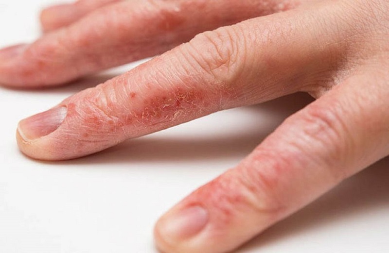 Khi nào cần tìm đến chuyên gia
