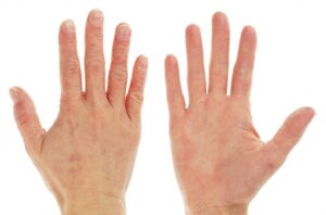 Cách chăm sóc da tay đúng cách để luôn mềm mịn và khỏe mạnh